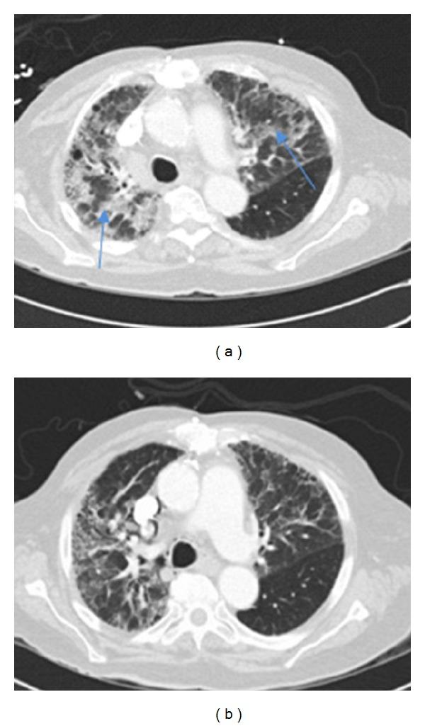 https://cdn.ncbi.nlm.nih.gov/pmc/blobs/100f/3388422/90a187648415/CRIM2012-680431.001.jpg