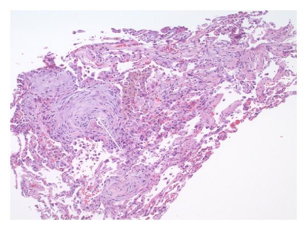 https://cdn.ncbi.nlm.nih.gov/pmc/blobs/100f/3388422/9a2a5862f921/CRIM2012-680431.002.jpg