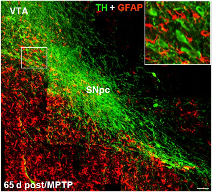https://cdn.ncbi.nlm.nih.gov/pmc/blobs/100f/7472866/78d73745c453/gr5.jpg