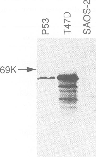 https://cdn.ncbi.nlm.nih.gov/pmc/blobs/1017/394860/fb194ca9b476/emboj00051-0210-c.jpg