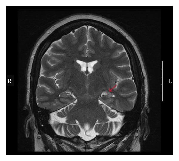 https://cdn.ncbi.nlm.nih.gov/pmc/blobs/101e/3420605/ad573cfaecc3/ERT2011-303624.003.jpg