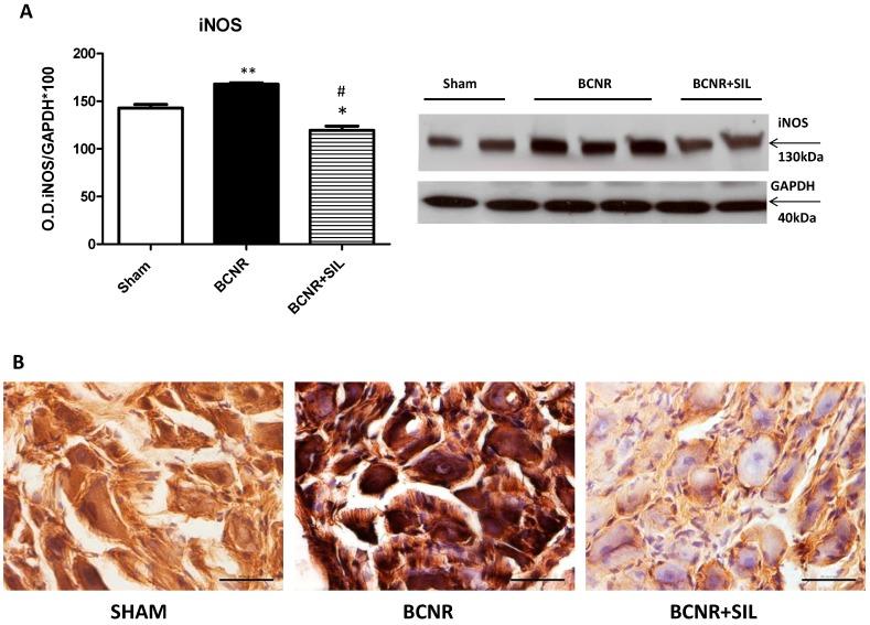 https://cdn.ncbi.nlm.nih.gov/pmc/blobs/1024/4227157/ddf30693344f/ijms-15-17204-g004.jpg