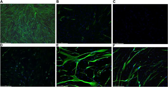 https://cdn.ncbi.nlm.nih.gov/pmc/blobs/1027/10229783/1cd6343f8892/fphys-14-1145047-g003.jpg