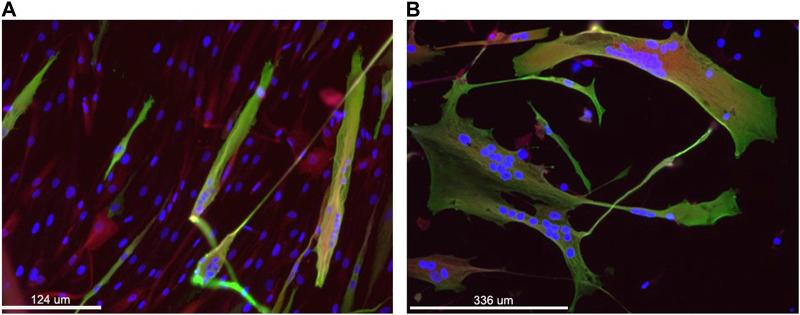 https://cdn.ncbi.nlm.nih.gov/pmc/blobs/1027/10229783/b2a3043a5acd/fphys-14-1145047-g002.jpg