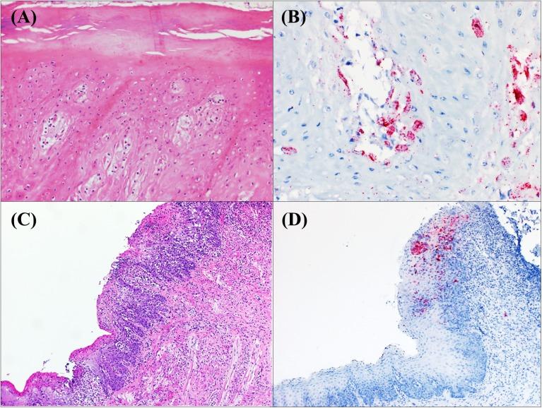 https://cdn.ncbi.nlm.nih.gov/pmc/blobs/1032/5386259/bedf105586cf/pone.0173190.g001.jpg