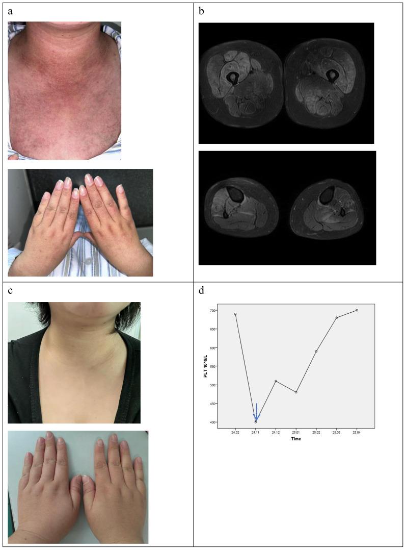 https://cdn.ncbi.nlm.nih.gov/pmc/blobs/1034/12198177/00c08f77dc33/fimmu-16-1591631-g001.jpg