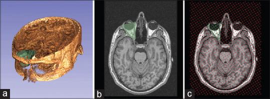 https://cdn.ncbi.nlm.nih.gov/pmc/blobs/1037/7518488/b18ba31235ba/NJMS-11-20-g006.jpg