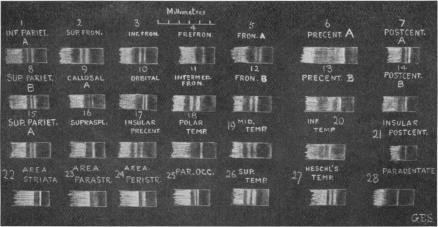 https://cdn.ncbi.nlm.nih.gov/pmc/blobs/103d/1289123/b4384d104b1e/janatphys00040-0003-a.jpg