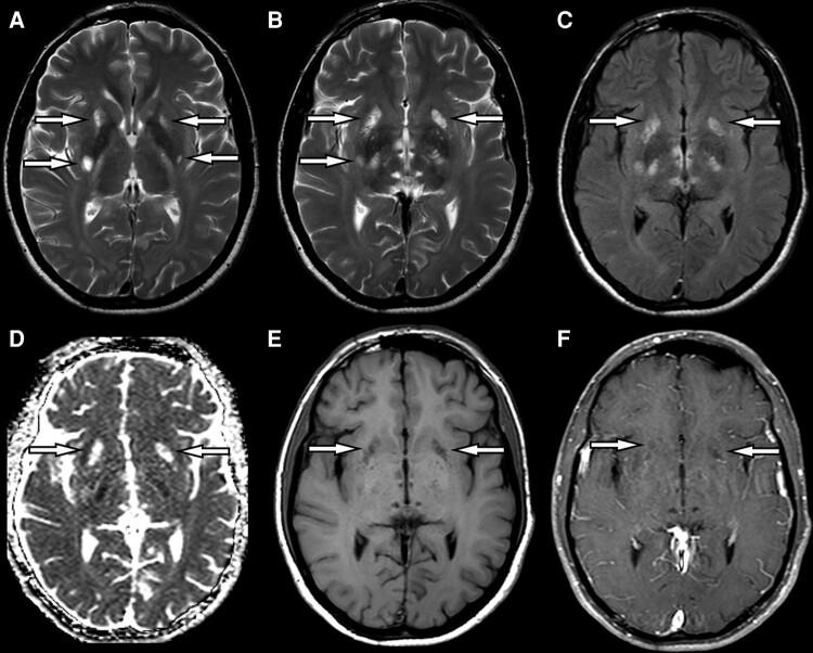 https://cdn.ncbi.nlm.nih.gov/pmc/blobs/1040/10763528/928e73bedeb7/fcad273f2.jpg