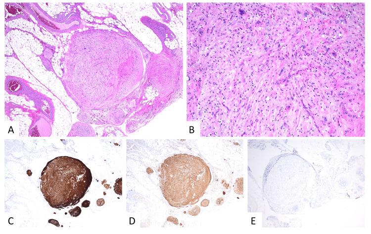 https://cdn.ncbi.nlm.nih.gov/pmc/blobs/1041/10937043/08c0ddd6caf6/cureus-0016-00000054080-i04.jpg