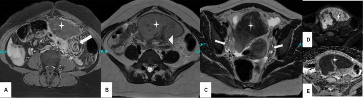 https://cdn.ncbi.nlm.nih.gov/pmc/blobs/1049/10505588/8e78213c3bc9/gr2.jpg
