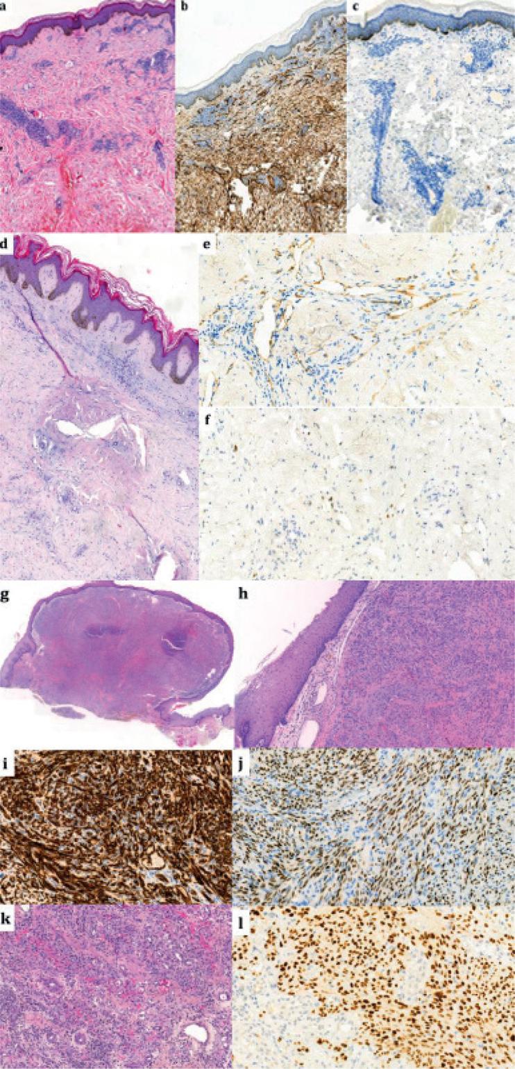https://cdn.ncbi.nlm.nih.gov/pmc/blobs/1051/9631296/421153bce6f5/ActaDV-102-581-g005.jpg