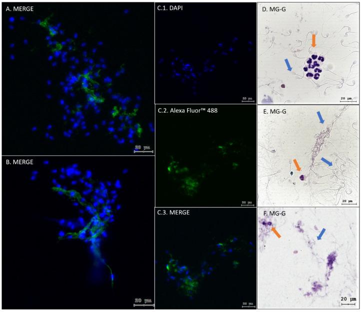 https://cdn.ncbi.nlm.nih.gov/pmc/blobs/105a/11172674/26c408a47c29/ijms-25-06216-g002.jpg
