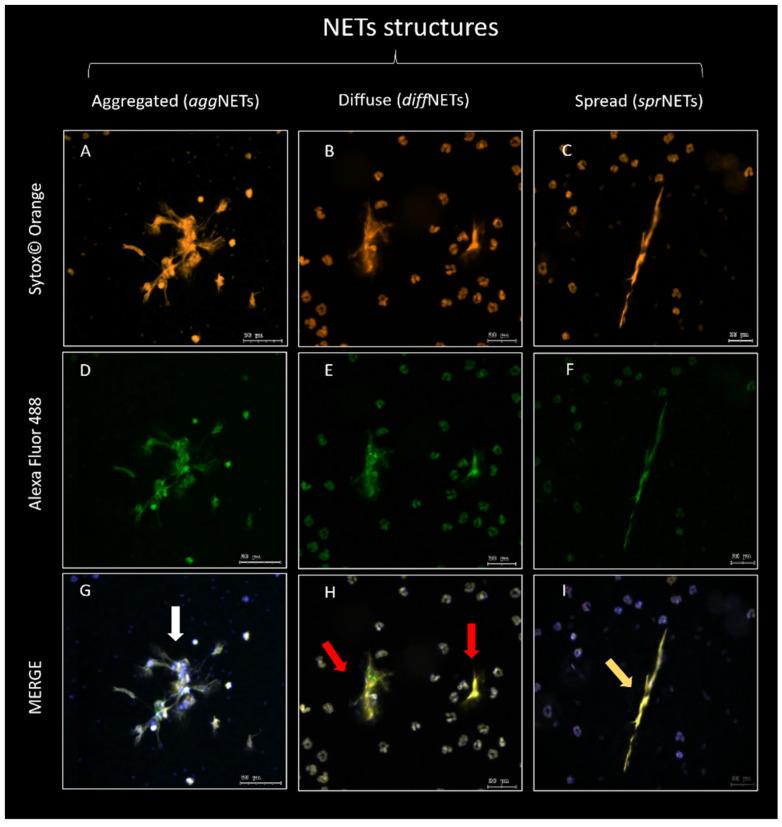 https://cdn.ncbi.nlm.nih.gov/pmc/blobs/105a/11172674/3c99d9c76042/ijms-25-06216-g004.jpg