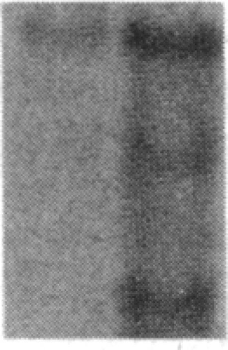 https://cdn.ncbi.nlm.nih.gov/pmc/blobs/105a/443191/858ba0b44473/jcinvest00052-0287-b.jpg
