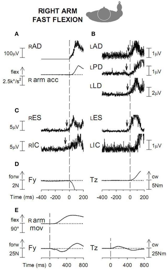https://cdn.ncbi.nlm.nih.gov/pmc/blobs/105a/5374888/557b94c917e0/fnhum-11-00152-g0009.jpg