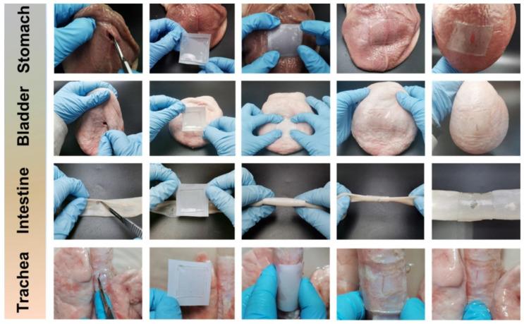 https://cdn.ncbi.nlm.nih.gov/pmc/blobs/1065/12027129/821e4ce1413a/gels-11-00234-g009.jpg