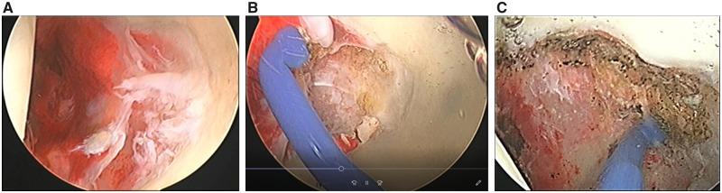 https://cdn.ncbi.nlm.nih.gov/pmc/blobs/1065/6990388/554d9461925e/hnz052f3.jpg