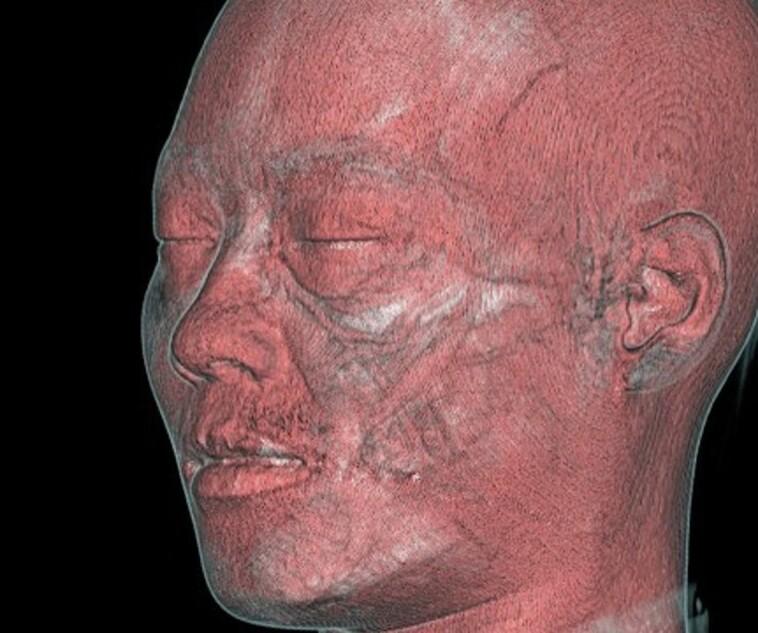 https://cdn.ncbi.nlm.nih.gov/pmc/blobs/1070/10270653/bbc030ed7008/ojad043f1.jpg