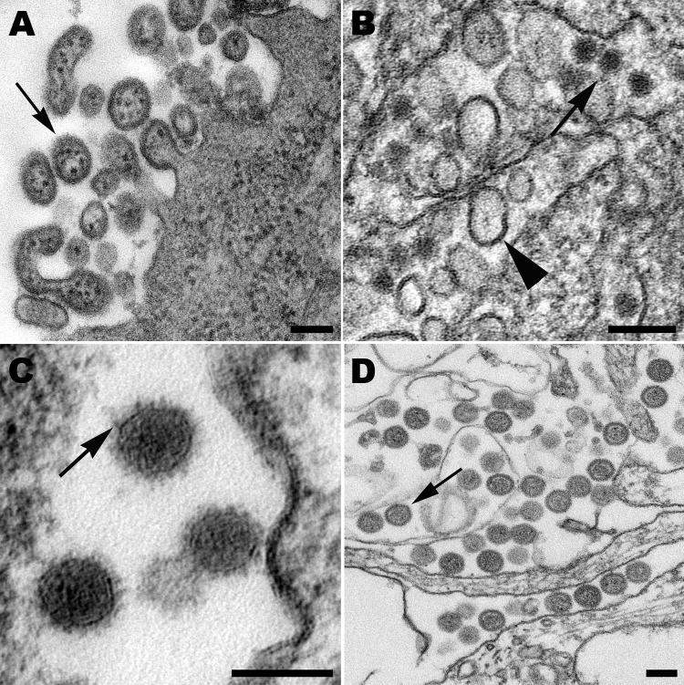 https://cdn.ncbi.nlm.nih.gov/pmc/blobs/1071/3713842/e48aefb43196/13-0173-F2.jpg