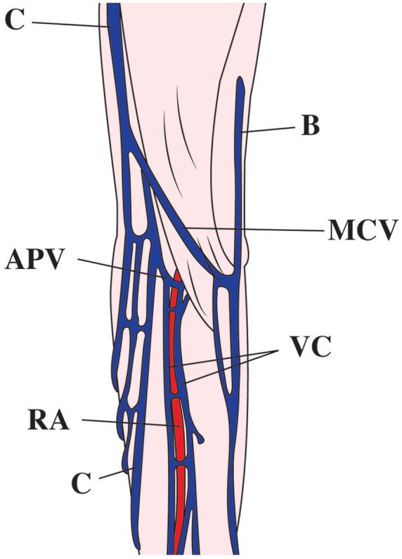 https://cdn.ncbi.nlm.nih.gov/pmc/blobs/1073/8108077/921c52414c9a/10.1177_2473974X211006927-fig1.jpg