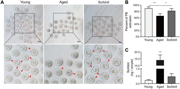 https://cdn.ncbi.nlm.nih.gov/pmc/blobs/1073/8714154/dcc0d083c9ca/aging-13-203747-g002.jpg