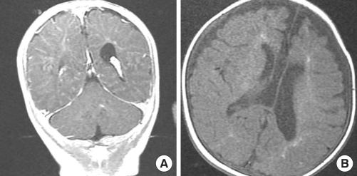 https://cdn.ncbi.nlm.nih.gov/pmc/blobs/1074/3031021/6311963c045a/jkms-26-308-g004.jpg