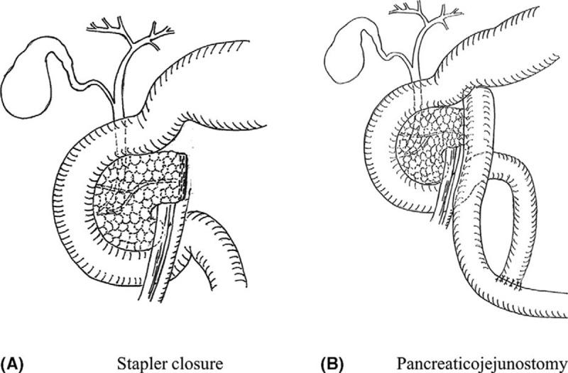 https://cdn.ncbi.nlm.nih.gov/pmc/blobs/1078/4902322/2121662fa1d0/ansu-264-180-g001.jpg