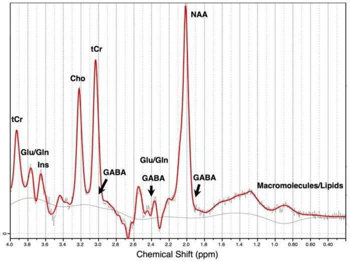 https://cdn.ncbi.nlm.nih.gov/pmc/blobs/1082/9316447/01c0fb395cbc/brainsci-12-00918-g001.jpg