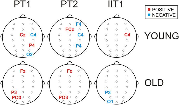https://cdn.ncbi.nlm.nih.gov/pmc/blobs/1088/8516400/a2716921f6b5/fnagi-13-682499-g004.jpg