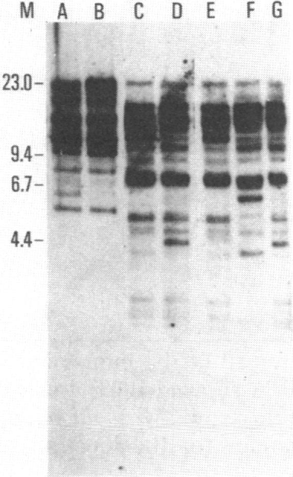 https://cdn.ncbi.nlm.nih.gov/pmc/blobs/108c/280058/e552ef15e2c9/pnas00260-0255-a.jpg