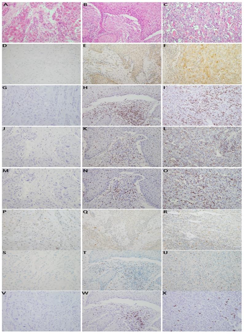https://cdn.ncbi.nlm.nih.gov/pmc/blobs/1090/5630402/e36c5f128276/oncotarget-08-66178-g002.jpg