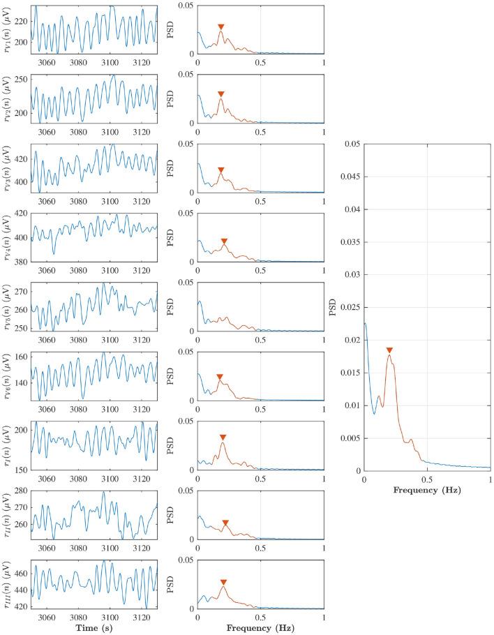https://cdn.ncbi.nlm.nih.gov/pmc/blobs/1099/8060635/15eeff981f7d/fphys-12-653492-g0003.jpg
