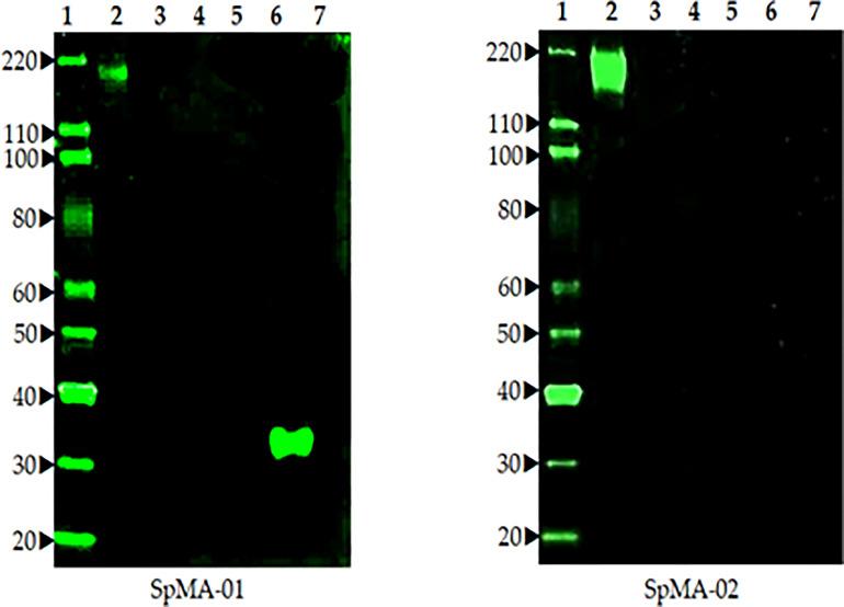 https://cdn.ncbi.nlm.nih.gov/pmc/blobs/109b/9995903/c2b080694e5c/fimmu-14-1111644-g003.jpg