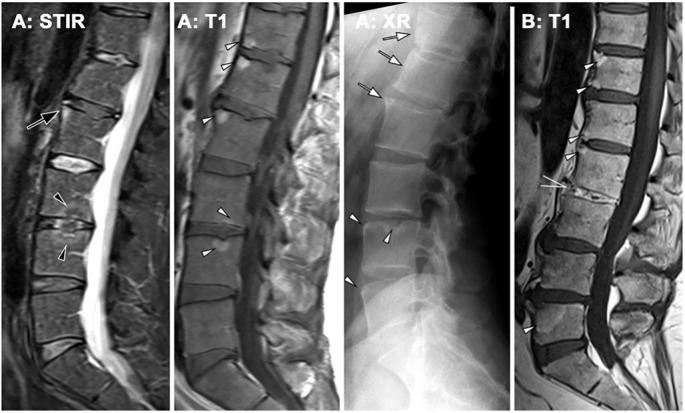 https://cdn.ncbi.nlm.nih.gov/pmc/blobs/109d/12350260/cbcf2a96687a/fimmu-16-1599995-g003.jpg