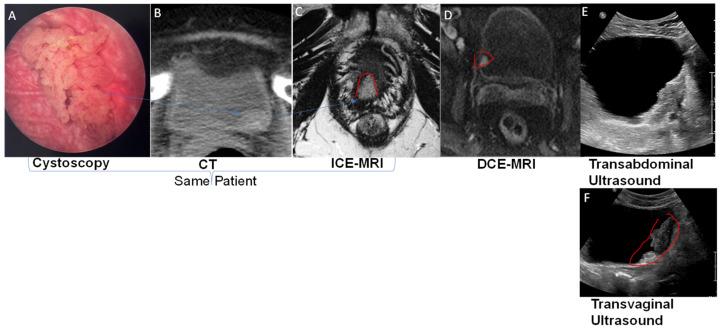 https://cdn.ncbi.nlm.nih.gov/pmc/blobs/109f/10217503/12e41bccd5c6/curroncol-30-00350-g002.jpg