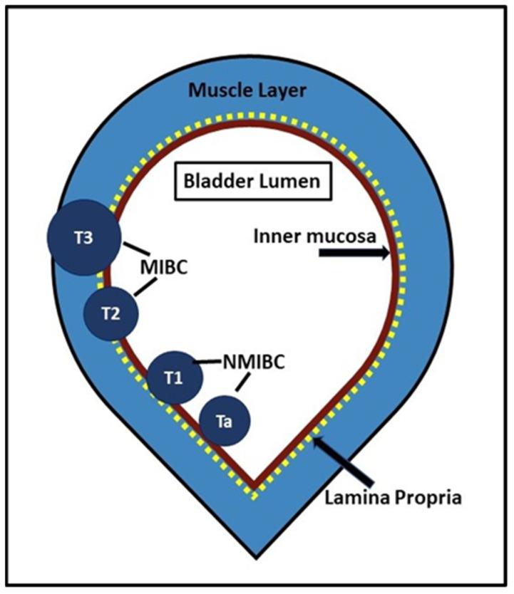 https://cdn.ncbi.nlm.nih.gov/pmc/blobs/109f/10217503/5ec99b0069ef/curroncol-30-00350-g001.jpg