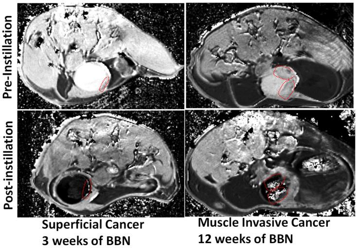 https://cdn.ncbi.nlm.nih.gov/pmc/blobs/109f/10217503/cad12e5e0ca2/curroncol-30-00350-g005.jpg