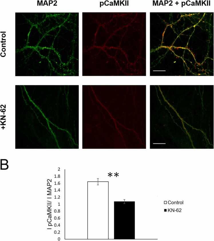 https://cdn.ncbi.nlm.nih.gov/pmc/blobs/109f/8777283/66e6903e8e0b/gr1.jpg