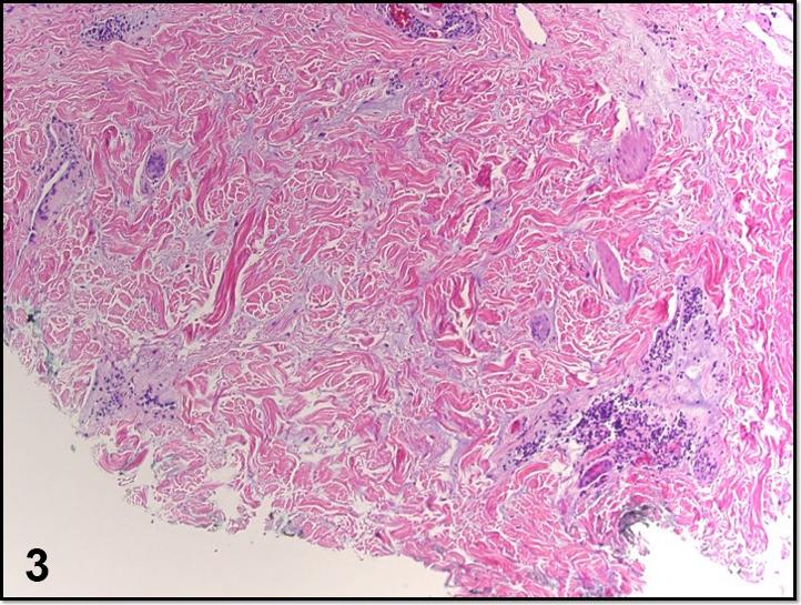 https://cdn.ncbi.nlm.nih.gov/pmc/blobs/10a4/8113992/0a8060615dcc/gr3.jpg