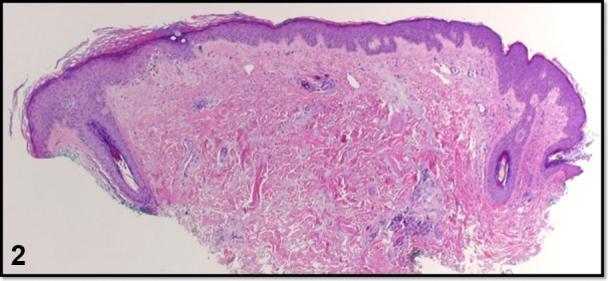 https://cdn.ncbi.nlm.nih.gov/pmc/blobs/10a4/8113992/76866b1b62b7/gr2.jpg