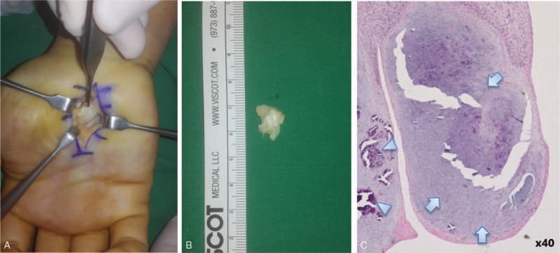 https://cdn.ncbi.nlm.nih.gov/pmc/blobs/10a5/6314781/8319cfe033d2/medi-97-e13943-g002.jpg