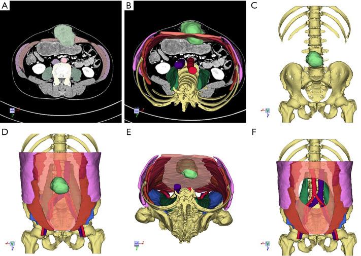 https://cdn.ncbi.nlm.nih.gov/pmc/blobs/10a7/8184446/f12e3abdb08d/atm-09-10-874-f3.jpg