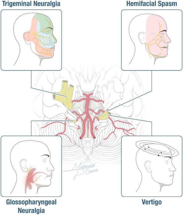 https://cdn.ncbi.nlm.nih.gov/pmc/blobs/10af/11724535/ca0feb7b32d1/12893_2025_2762_Fig1_HTML.jpg