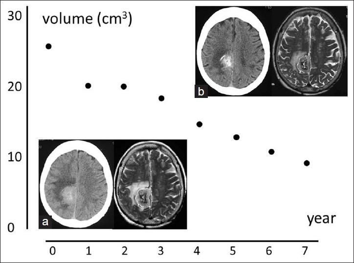 https://cdn.ncbi.nlm.nih.gov/pmc/blobs/10b0/4061579/ca7bf786450a/SNI-5-73-g001.jpg