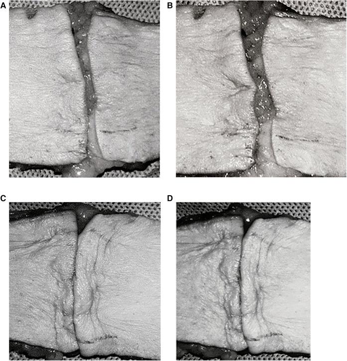 https://cdn.ncbi.nlm.nih.gov/pmc/blobs/10b2/12106352/ad580cebabbc/fsurg-12-1587582-g004.jpg
