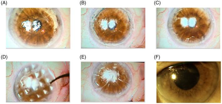 https://cdn.ncbi.nlm.nih.gov/pmc/blobs/10b3/10099462/21f9e8c5752d/JBM-111-684-g007.jpg