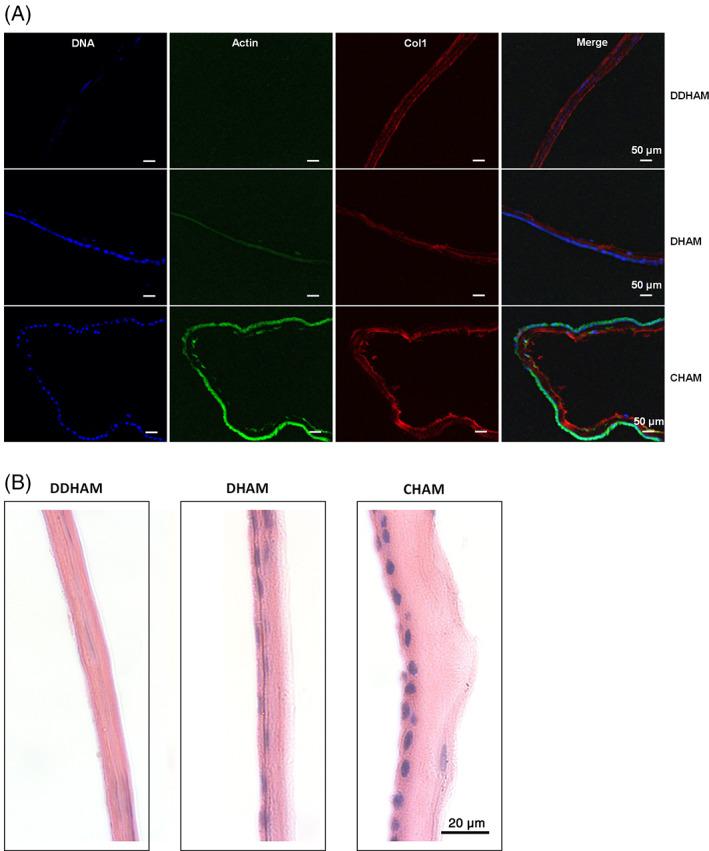 https://cdn.ncbi.nlm.nih.gov/pmc/blobs/10b3/10099462/e871450d4447/JBM-111-684-g001.jpg