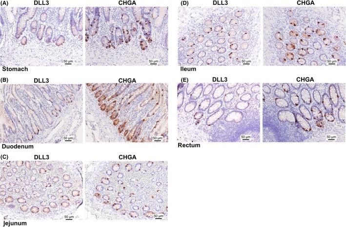 https://cdn.ncbi.nlm.nih.gov/pmc/blobs/10b3/6778628/d4114ca0e1df/CAS-110-3122-g002.jpg