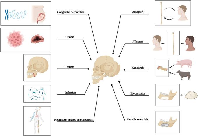 https://cdn.ncbi.nlm.nih.gov/pmc/blobs/10ba/10469012/408eeae8b628/fbioe-11-1259696-g001.jpg